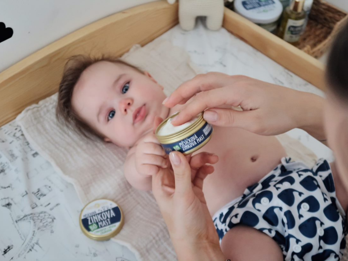 Organikus körömvirág cinkkenőcs 70 ml – kozmetikai hiba